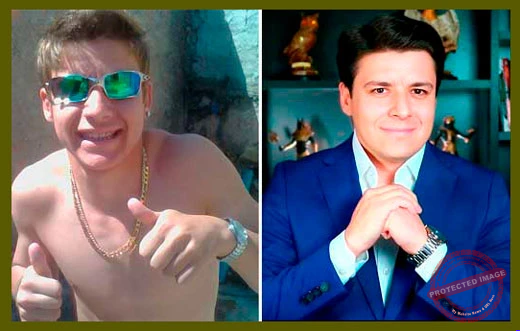 Mateus Amorim: montagem de antes e depois